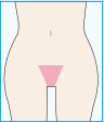 triangle part hair removal