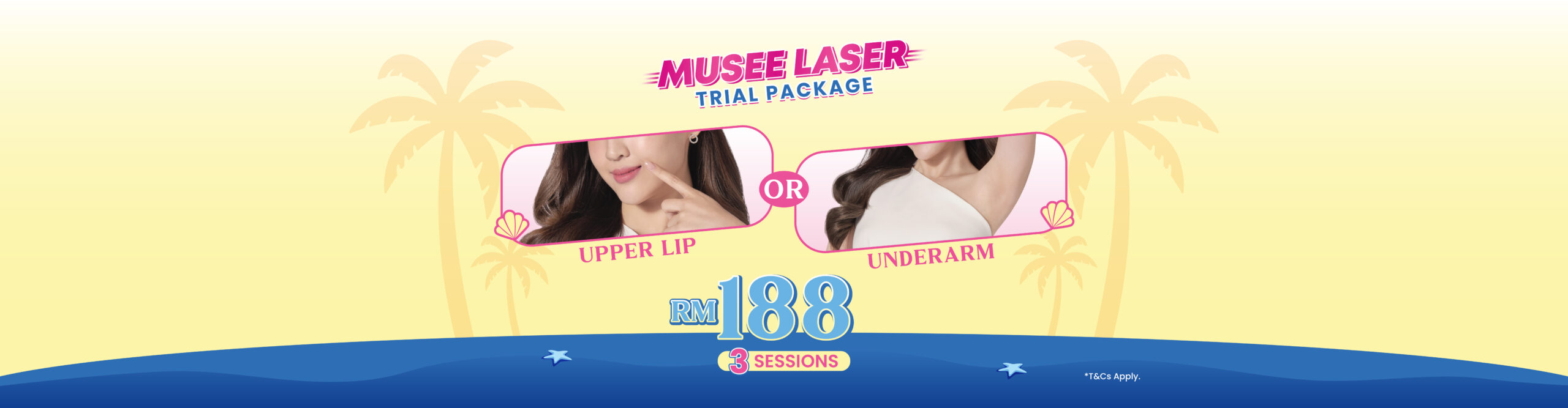 RM188 Musee Laser Trial